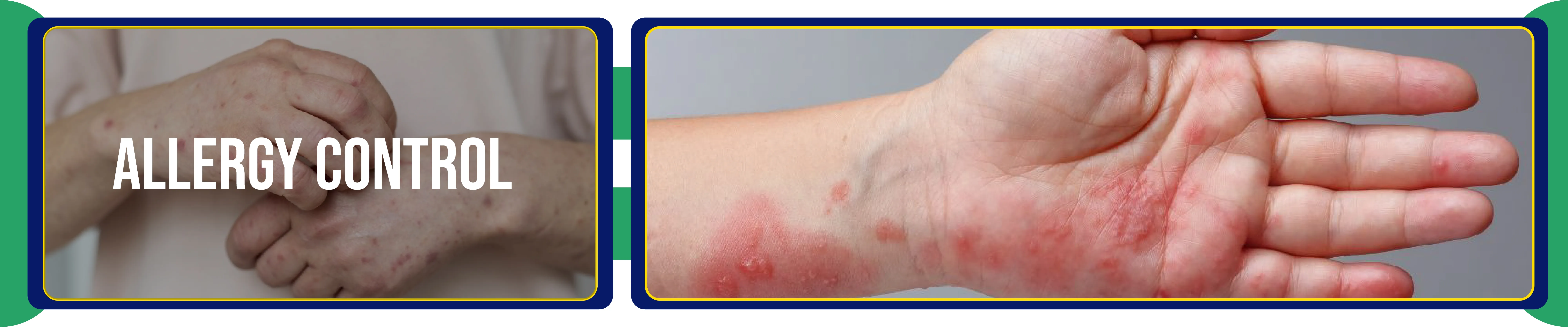 carpet cleaners in Brooklyn, carpet cleaning in Brooklyn, carpet cleaning bkln, carpet cleaners in brooklyn,  commercial carpet cleaning, commercial carpet cleaning in brooklyn,carpet cleaning in brooklyn,  brooklyn rug cleaners, rug cleaning services in brooklyn, same day carpet cleaning, same day rug cleaning